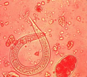 Lirfa þráðormsins Strongyloides stercoralis